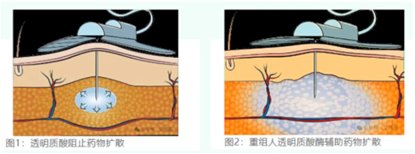 新股前瞻|研發投入現下滑趨勢，寶濟藥業IPO故事含金量有幾分？ - 圖片4